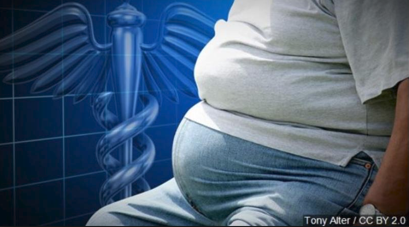 obesity study